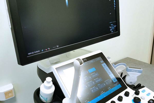 В поликлинике Урайской больницы появились новые аппараты УЗИ