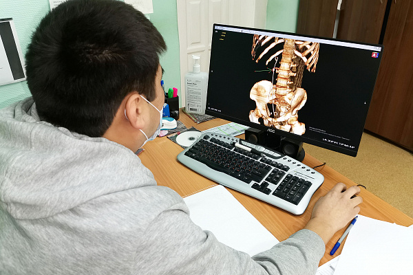 В Урайской больнице впервые удалили крупный камень из мочеточника лапароскопическим методом